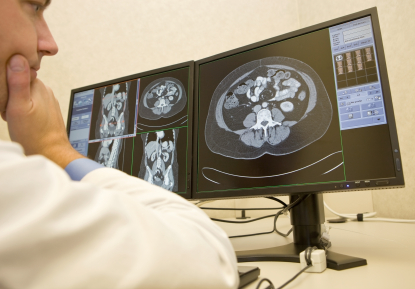 CT screening found to be more effective than x-rays